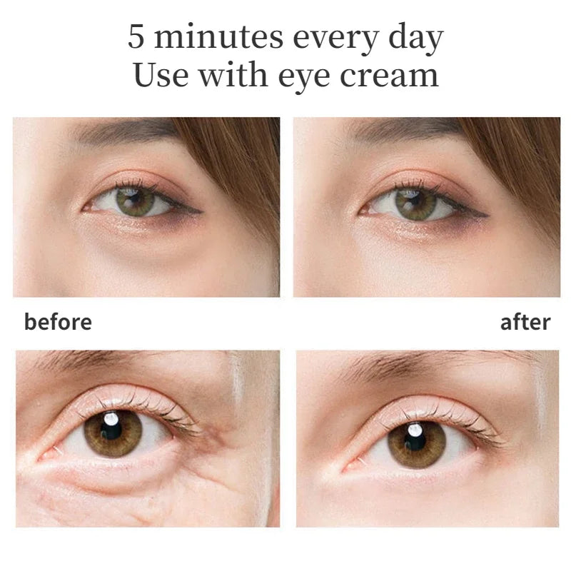 Appareil de Beauté Thermique pour les Yeux - Anti-Cernes et Anti-Rides